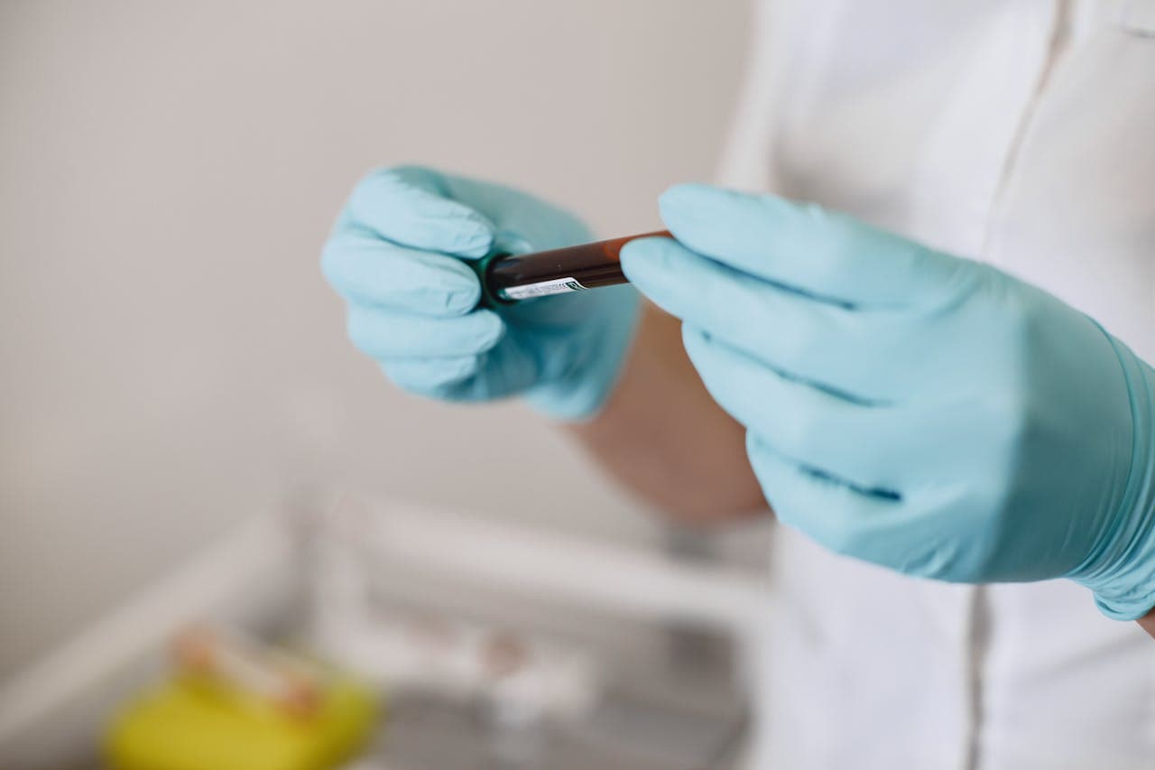 Manos con guantes sosteniendo un tubo con muestra de sangre